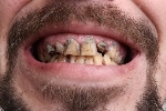 ⬇ Скачать картинки Плохие зубы, стоковые фото Плохие зубы в хорошем  качестве | Depositphotos